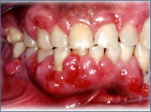 University work week, Curitiba, Brazil, 2007.