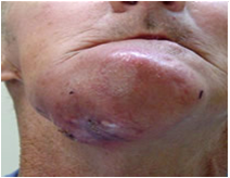 Monografía de Especialidad en Odontogeriatría: