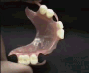 Prótesis Flexibles (Nylon)