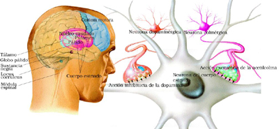 Enfermedad de Parkinson